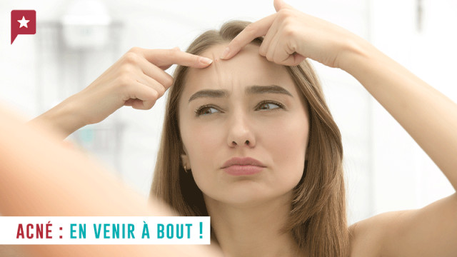 Acné : quelques conseils pour en venir à bout