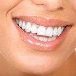 Barsourire