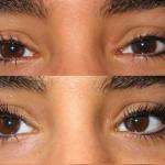 Onglescils